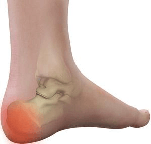 Causes of clearance back foot pain